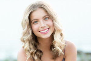 Veneers by Dr. Hansen